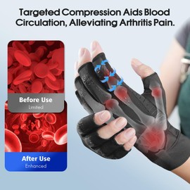 Donfri Osteoarthritis Fingerless Gloves for Compression Stockings Women Men Rheumatism Arthritis Compression Gloves Relieve Pain from Rheumatism, RSI, Carpal Tunnel, Joint Pain (XL)