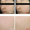 MEDITHERAPY Arbutin Skin Booster Serum with Boost Cap Package 5items