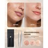 SGNEKOO Professional Facial Milia Removal Tool and Whitehead Extractor,Titanium Alloy