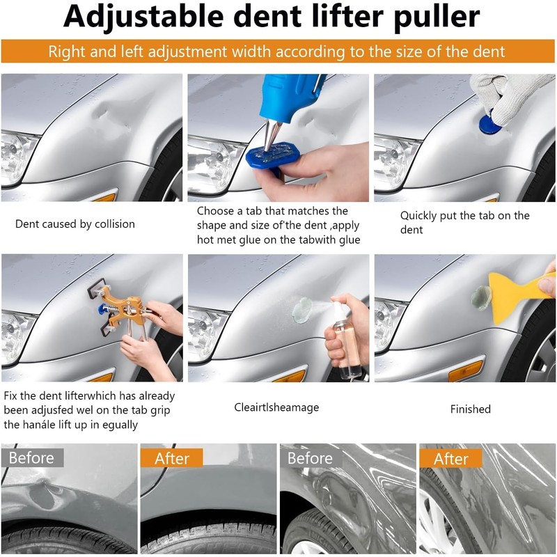 YUTAOWH Dent Puller Kit, Painless Dent Removal Kit with Adjustable