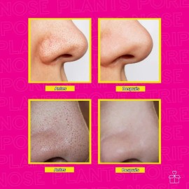 Crema Mgica Quita Puntos Negros Lanbena Con 60 Tiras Mixta                                                                                            