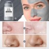Mascarilla Facial De Arcilla Para Puntos Negros 40 G