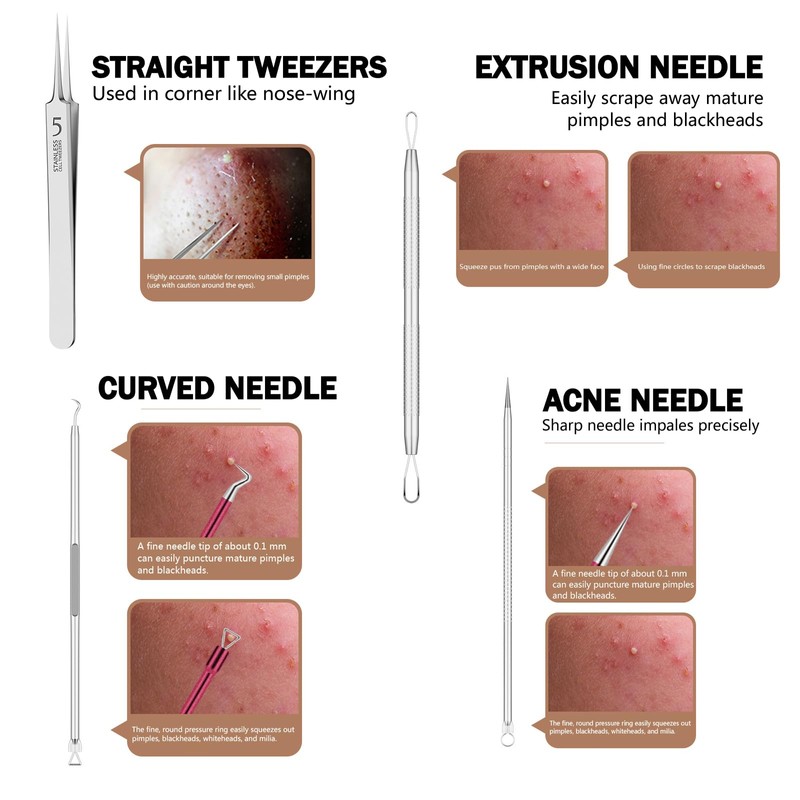 Blackhead Remover Pimple Popper Tool Kit 6 Pcs Blackhead Remover