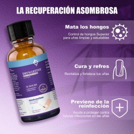 Fungicida Para Uñas Para Uñas Dañadas,rotas Y Decoloradas