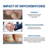 Sulfato De Aluminio Ninu Clarificador Floculante 20 Kg