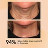Firming Lifting Neck Cream for Saggy Skin, AH-8 Firming Neck
