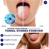 ORAVIX Tonsil Stone Removal Kit - Tonsil Stone Remover -