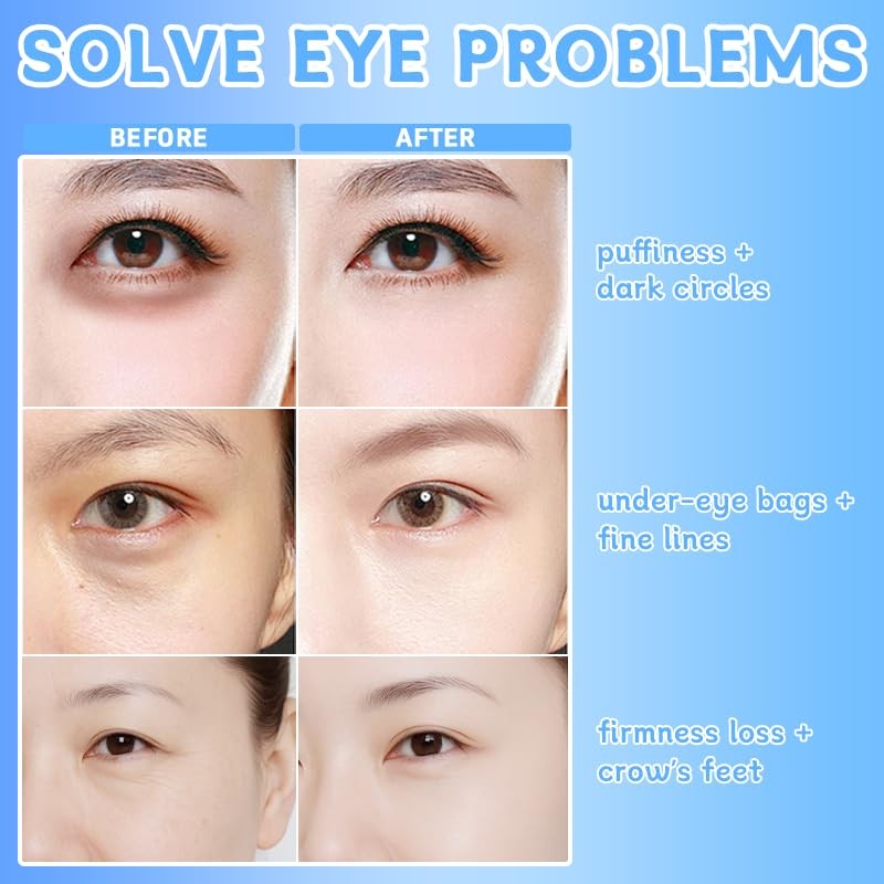Instant Firming Eye Serum,Visibly Reduces Under-Eye Bags, Wrinkles, Dark Circles,
