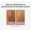 Kit Eucerin Anti-manchas + Anti-edad 30ml Serums Faciales