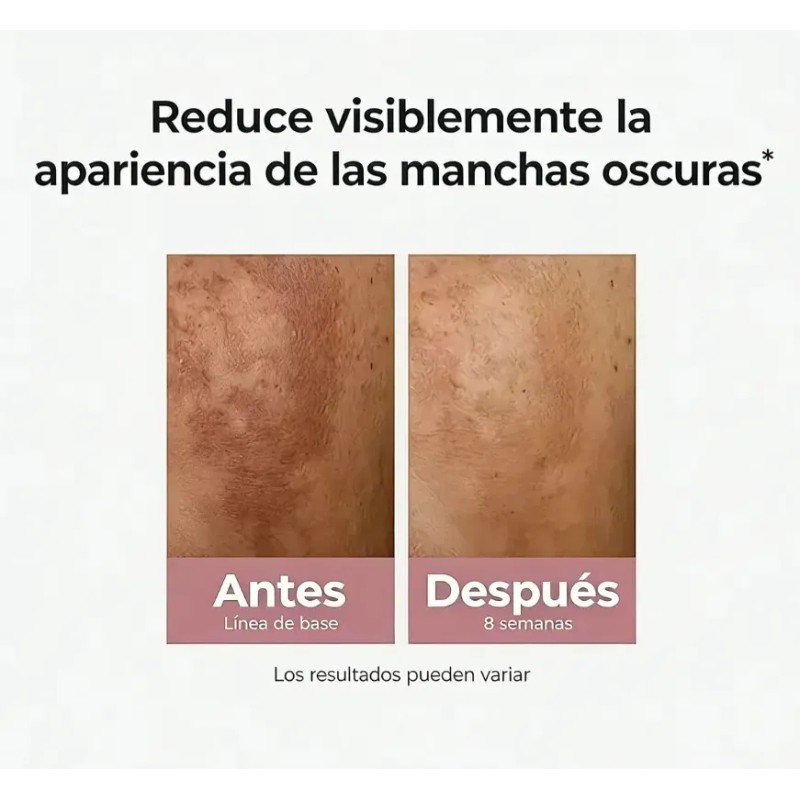 Kit Eucerin Anti-manchas + Anti-edad 30ml Serums Faciales