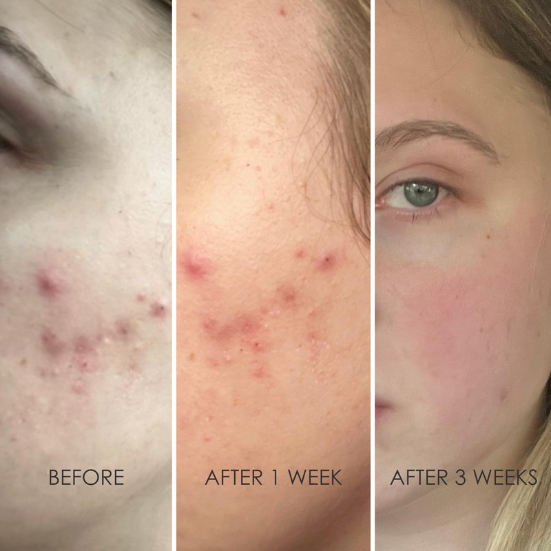 REFLEKT 3 Power Peptide Sculpting Face Cream