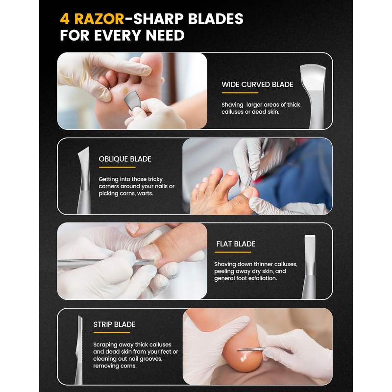 BEZOX 4PCS Pedicure Knife Set for Feet – Professional Ingrown