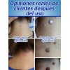Crema Quitar Verrugas Genitales Efectiva 20g