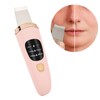 Face Skin Scrubber Vibration Face Peeling Machine Ultrasonic Exfoliating SkinCare