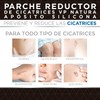 VP Natura Scar Reducer Patch 5 x 7.5 cmts 10