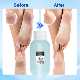 Callus Remover for Feet - Original, Powerful Formulation - Extra Strength Gel, Home Pedicure Foot Spa Results - Cracked & Dead Dry Skin Supplies -new01