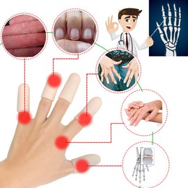 Gel Finger Cots, Finger Protector Support(14 PCS) NEW MATERIAL Finger Sleeves Great for Trigger Finger, Hand Eczema, Finger Cracking, Finger Arthritis and More. (Beige, Short)