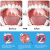 Upgraded Tonsil Stone Remover with Camera, Visual Tonsil Stone Removal