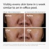 The Ordinary AHA 30% + BHA 2% Peeling Solution, Advanced