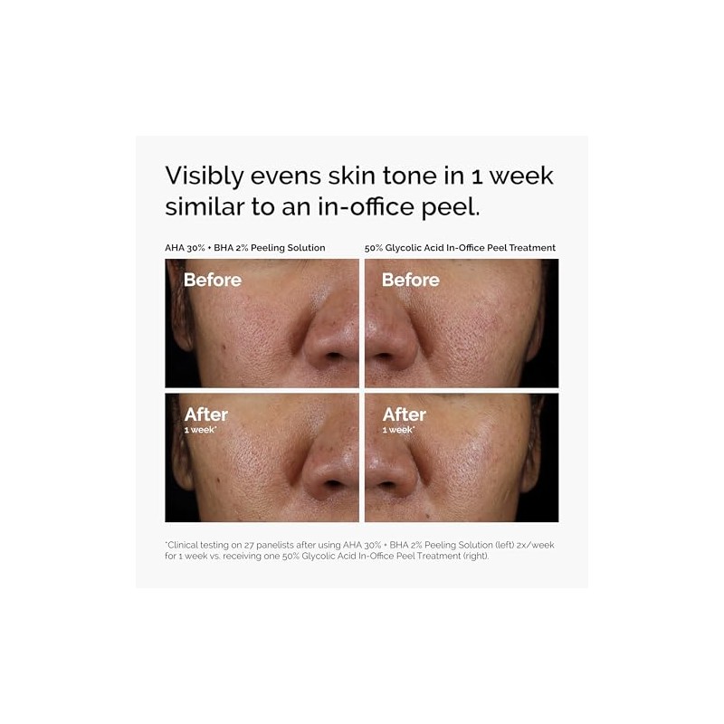 The Ordinary AHA 30% + BHA 2% Peeling Solution, Advanced