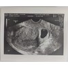 Prank 2D Customized Fake Ultrasound Single Photo ONLY NO Gender