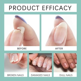 2pcs Nail Care Pen,Fungus Nail Repair Pen,N/ail Care P/en Against N/ail Fungus,Fungal Na/il Serum P/en,Fungel Na/il Treatmant Extra Strong,Foot Care Nai/l Repair Pe/n,Anti Fungas Nai/l Strengthener