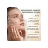 ADerma Epitheliale Ultra Repair Crema Antimarcas 40 ml