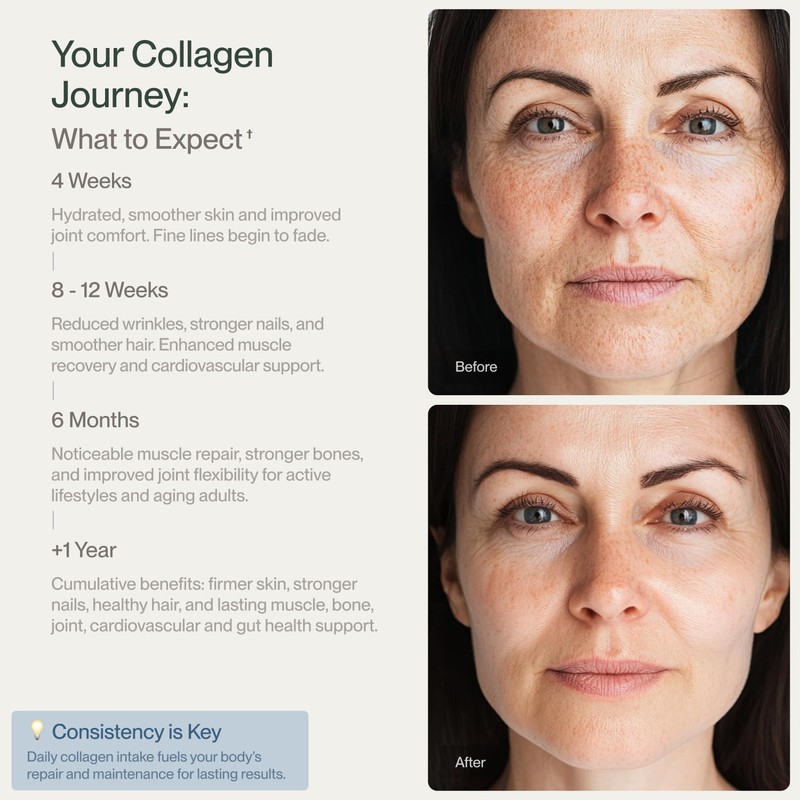 Colla Vita Collagen Peptides Powder Grass-Fed Pasture-Raised Hydrolyzed Collagen Powder,