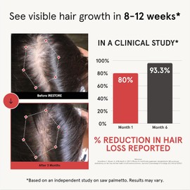 iRESTORE Hair Growth Supplement - Hair Loss Vitamins for Women and Men - Has Biotin Multivitamins & DHT Blocker to Reduce Hair Thinning - Hair Regrowth Pills for Thicker Fuller Volume - 30 Days Supply