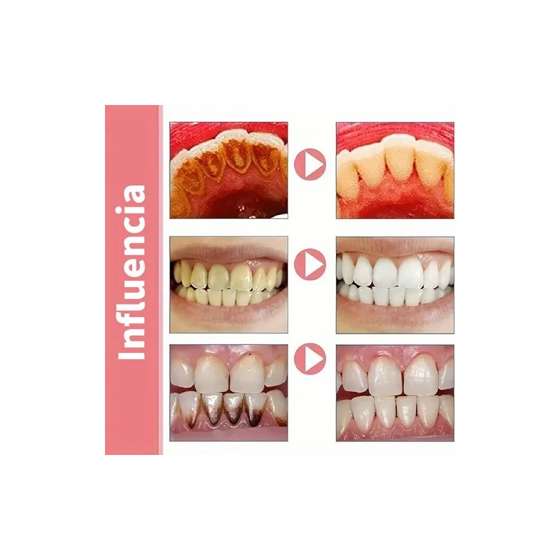 Pasta De Dientes Probiótica Blanqueadora De En 1 Tabletas