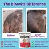 Dinovite Dog Probiotics for Yeast, Itchy Skin and Itchy Ears