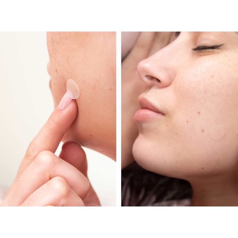 Maquillali Tea Tree Acné Pimple Parche, 44 Parches De Absorbente