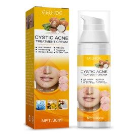 . Creme De Tratamento Para Acne: Combate A Acne Hormonal