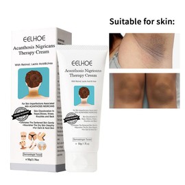[EELHOE] Skin Care Cream – Brightening & Moisturizing Body Lotion for Discoloration on Nape, Elbows, Knees, Knuckles & Back, Body Butter for Men & Women
