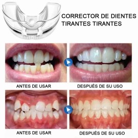 Retenedor Dientes Corrección Sonrisa