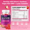2 Pack L-Lysine 1000mg Gummies for Immune Support & Skin