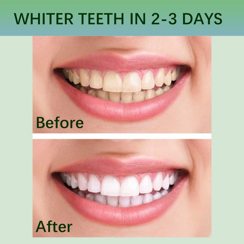 Teeth Whitening White Stripes Teeth, 28 Strips Teeth Whitening -