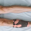 MedEduQuest Burn Wound Packing Trainer, Burn Wound Care Model, Severe