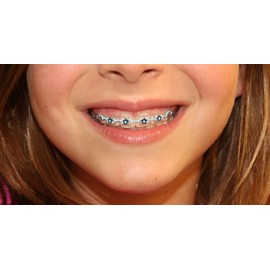 Brace Wax Alternative Bracket Cover Bumper Orthodontic Braces Accessories Snapcaps Turtle 10 Ct.