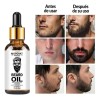 NOT MINOX - Balsamo Para Crecimiento De Barba Media O