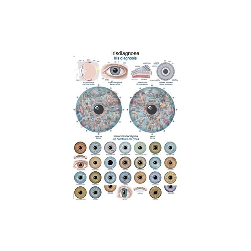 Educational Board "Iris Diagnosis", 50 x 70 cm