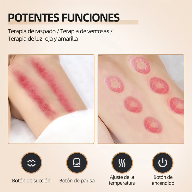 Ventosa Terapéutica Eléctrica De Masaje Cupping Inteligente