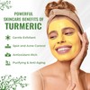 Wild Naturals Turmeric Clay Face Mask for Acne & Dark