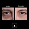Kit Anti Ojeras Y Arrugas Roll On + Serum Antiedad