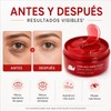 80 Parches para Ojos con Baba de Caracol Colágeno y