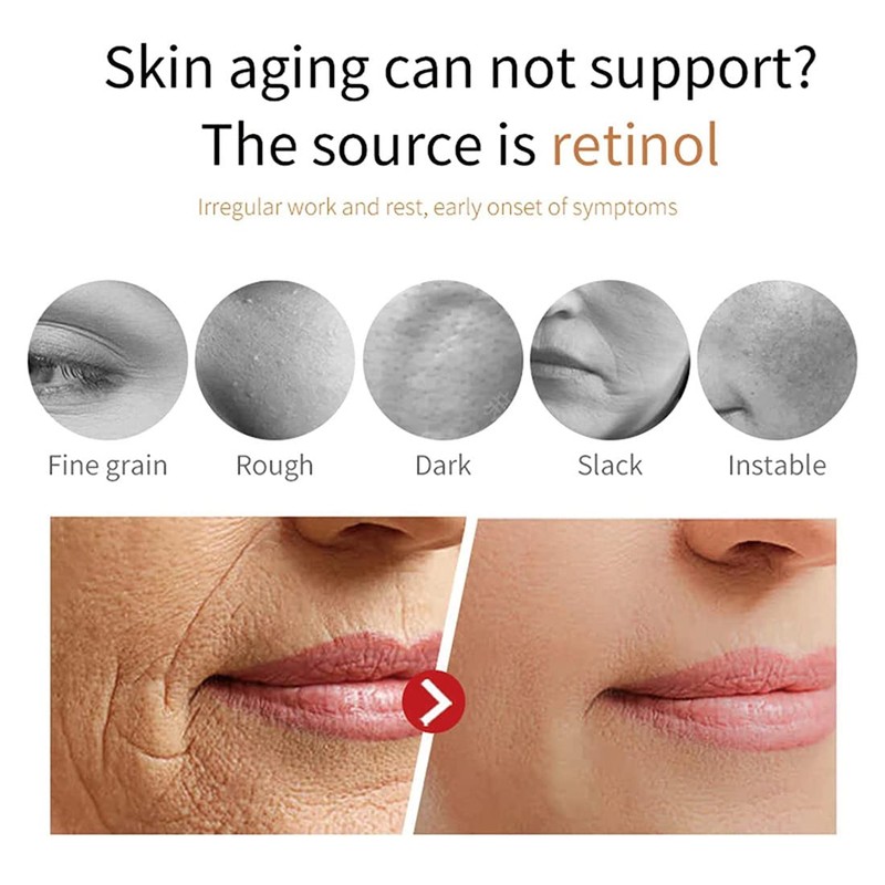 Eelhoe Eternity Vitamin C Serum Dark Spot Corrector, Esencia de