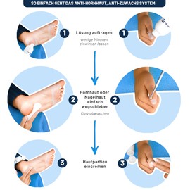 Mr. Fuss® No. 4 - Callus Remover Hand and Foot Care Set - Advanced Pack - 4 Pieces - Cuticle Removal - Quick Softening Action, Solution, Balm, Cotton Wool, Instruments