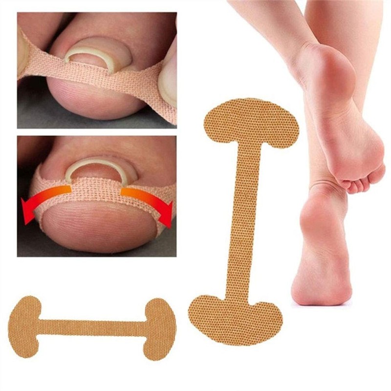 Tiras Correctoras de Uñas Encarnadas, Transpirables, Seguras, Eficaces, Tratamiento de