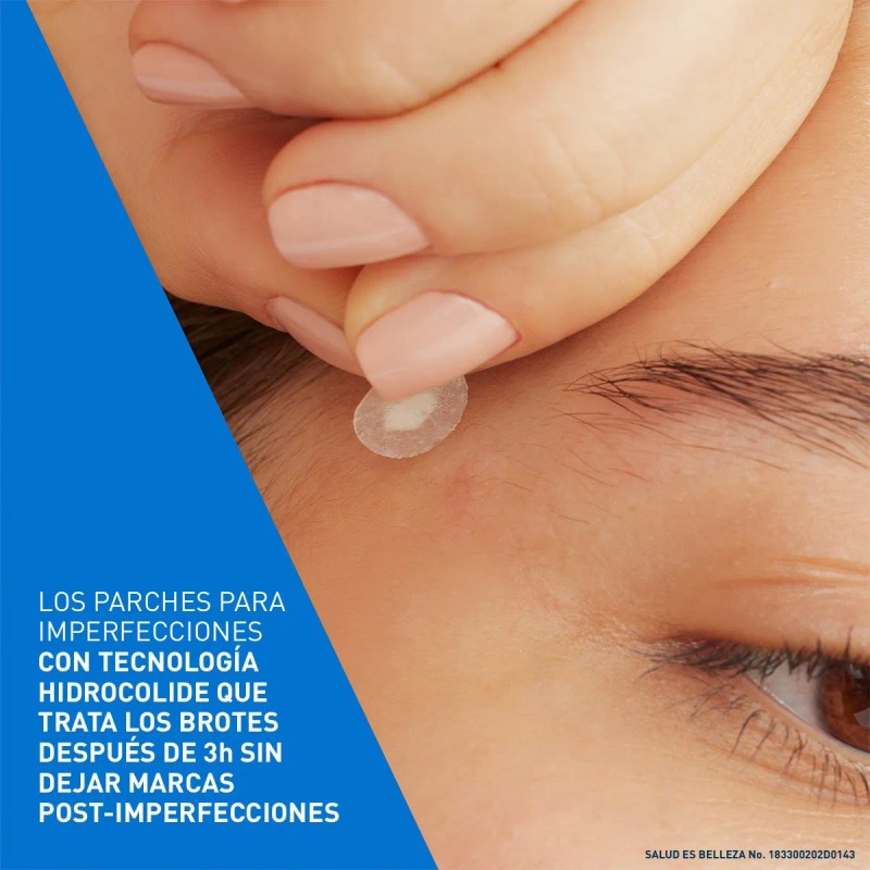 Cerave Parches Control Imperfeccion 22p Piel Tendencia Acné