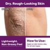Immuderm Beta Glucan Moisturizer - Beta-Glucan Power Moisturizer with Natural